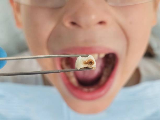 Best Emergency Broken Tooth Repair in Mcconnellsburg, PA